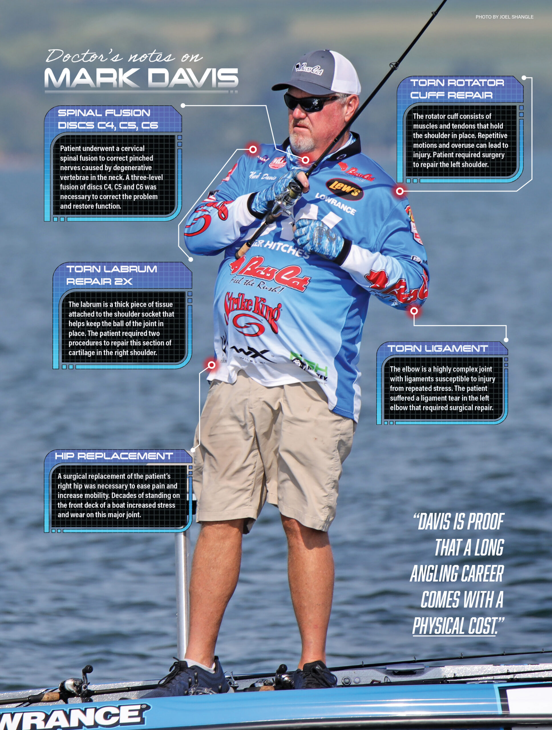 What are the main “families” of soft plastics you use for your bass fishing?  — Henry Gilbey